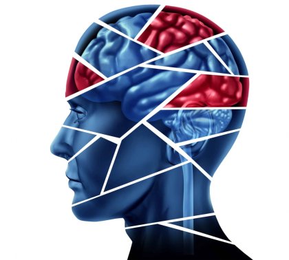 Klienti v  bdelej kóme 