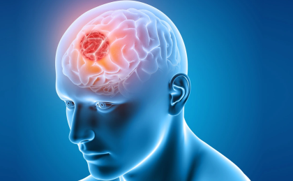 Frontotemporálna demencia 